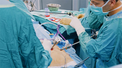 当院で実施している手術の約8割は、  腹腔鏡下手術